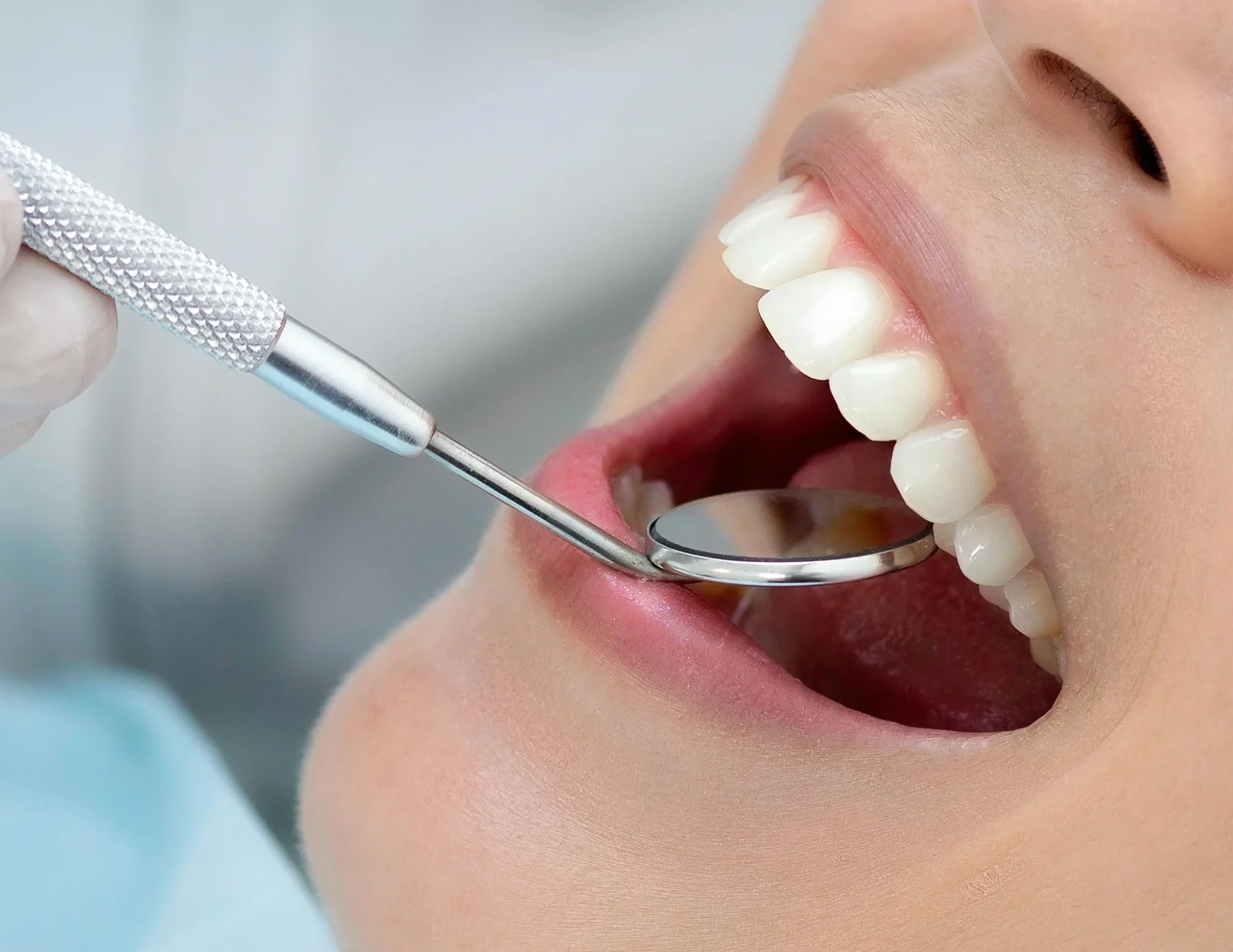 Профілактика