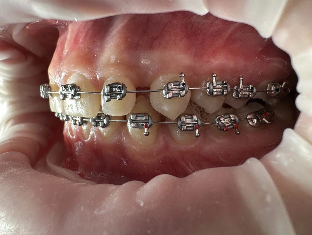 Ортодонтія