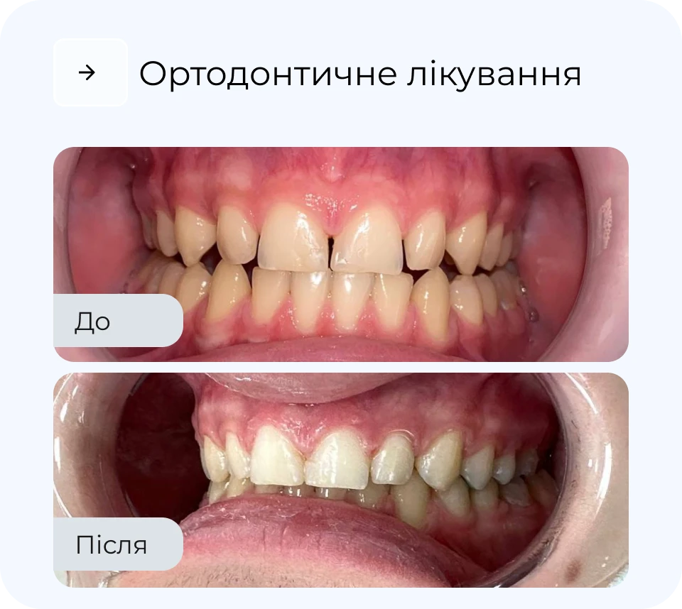 Результати