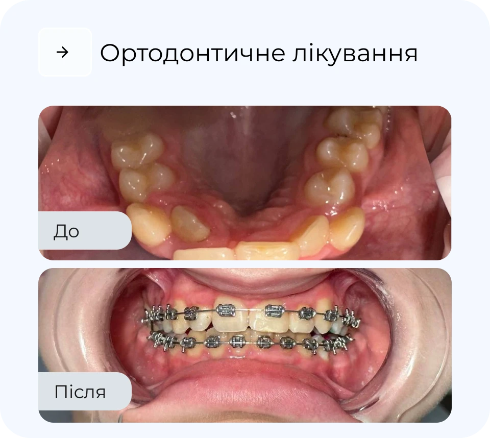 Результати