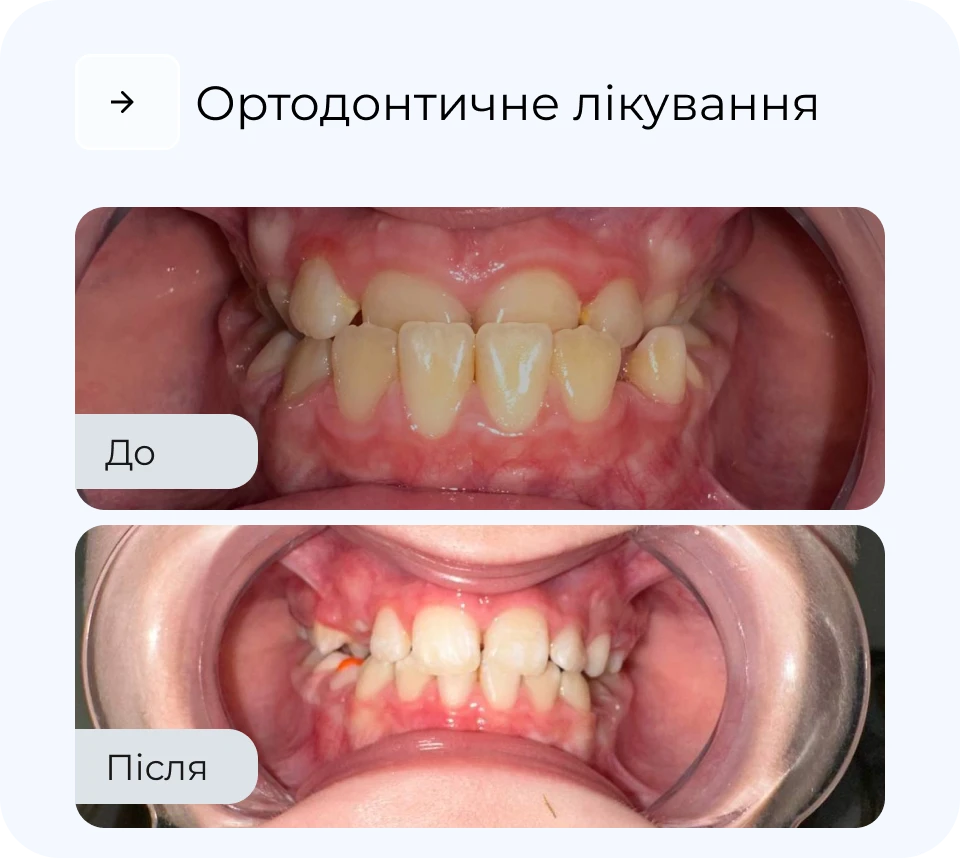 Результати